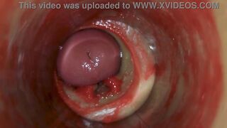 Camera Inside Deep Pussy Captures Huge Ejaculation of Sperm ASMR